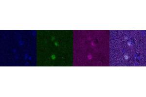 Immunohistochemistry (IHC) image for anti-Oligodendrocyte Lineage Transcription Factor 2 (OLIG2) antibody (ABIN7456250) (OLIG2 antibody)