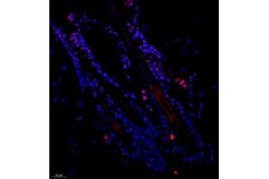 Immunofluorescence of paraffin embedded mouse skin using SRRM2 (ABIN7075555) at dilution of 1:650 (400x lens) (SRRM2 antibody)