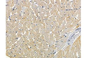 ABIN7095165 and ABIN7099221 at 1/100 staining rat heart tissue by IHC-P.