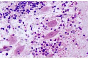 Anti-FZD8 / Frizzled 8 antibody IHC staining of human brain, cerebellum, purkinje neurons. (FZD8 antibody  (Extracellular Domain))