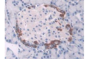 DAB staining on IHC-P; Samples: Rat Pancreas Tissue (UCP1 antibody  (AA 179-296))