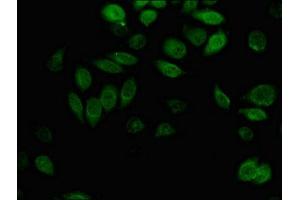 Immunofluorescent analysis of A549 cells using ABIN7143701 at dilution of 1:100 and Alexa Fluor 488-congugated AffiniPure Goat Anti-Rabbit IgG(H+L) (AKR1B1 antibody  (AA 114-230))