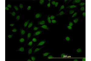 Immunofluorescence of monoclonal antibody to NR3C1 on HeLa cell. (Glucocorticoid Receptor antibody  (AA 51-140))