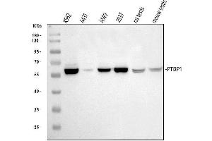 Western blot analysis of PTBP1 using anti-PTBP1 antibody (ABIN7599451). (PTBP1 antibody  (AA 1-504))