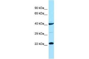 Host: Rabbit Target Name: ASCL1 Sample Type: COLO205 Whole cell lysates Antibody Dilution: 1. (ASCL1 antibody  (N-Term))