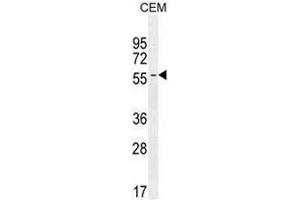 INHBA Antibody (N-term) western blot analysis in CEM cell line lysates (35µg/lane). (INHBA antibody  (N-Term))