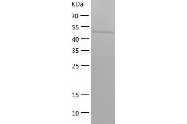 HSPA13 Protein (AA 23-471) (His tag)