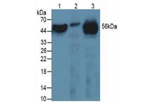 Western blot analysis of (1) Human Serum, (2) Human Liver Tissue and (3) Mouse Heart Tissue.