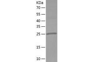 Western Blotting (WB) image for Hydroxysteroid (17-Beta) Dehydrogenase 8 (HSD17B8) (AA 1-261) protein (His tag) (ABIN7288172) (HSD17B8 Protein (AA 1-261) (His tag))