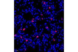Immunofluorescence (Paraffin-embedded Sections) (IF (p)) image for anti-Lymphocyte Antigen 6 Complex, Locus G (Ly6g) antibody (ABIN7074524)