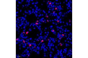 Immunofluorescence (Paraffin-embedded Sections) (IF (p)) image for anti-Lymphocyte Antigen 6 Complex, Locus G (Ly6g) antibody (ABIN7074524)