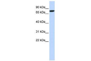 DLL1 antibody used at 1 ug/ml to detect target protein. (DLL1 antibody)