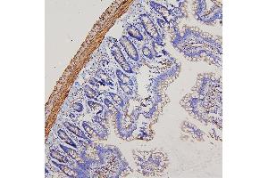 IHC analysis of FLNA using anti-FLNA antibody (ABIN7601782).