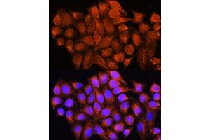 Immunofluorescence analysis of HeLa cells using D antibody (ABIN6129731, ABIN6137329, ABIN6137330 and ABIN6225254) at dilution of 1:100. (ATP5F1D antibody  (AA 1-168))