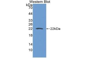 Western blot analysis of the recombinant protein. (CD276 antibody  (AA 47-213))