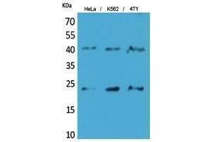 Western Blotting (WB) image for anti-Transmembrane Protein 173 (TMEM173) (C-Term) antibody (ABIN3178504) (STING/TMEM173 antibody  (C-Term))