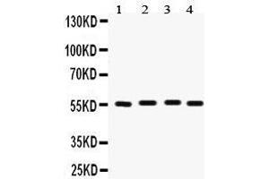 Western Blotting (WB) image for anti-Fascin (FSCN1) (AA 42-73), (N-Term) antibody (ABIN3042407) (Fascin antibody  (N-Term))