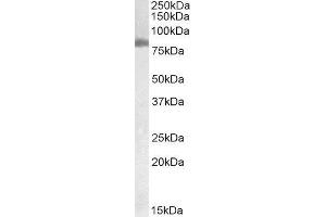 Western Blotting (WB) image for Transglutaminase 2 (C Polypeptide, Protein-Glutamine-gamma-Glutamyltransferase) (TGM2) peptide (ABIN369455)