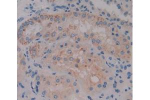 IHC-P analysis of kidney tissue, with DAB staining. (ACOX1 antibody  (AA 210-409))