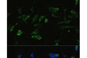 Immunofluorescence (IF) image for anti-Heat Shock Protein 90kDa alpha (Cytosolic), Class A Member 1 (HSP90AA1) antibody (ABIN7256124)