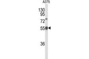 Western blot analysis of DLL3 (arrow) in A375 cell line lysates (35ug/lane) using DLL3  (DLL3 antibody  (C-Term))