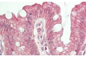 Immunohistochemistry (IHC) image for anti-Slit Homolog 2 (Drosophila) (SLIT2) (AA 1416-1528) antibody (ABIN7438007)