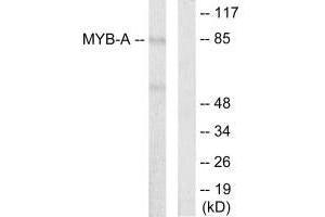 Western blot analysis of extracts from LOVO cells, using MYB-A antibody. (MYBL1 antibody)