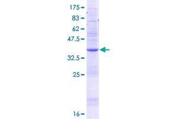 TBL1XR1 Protein (AA 1-102) (GST tag)