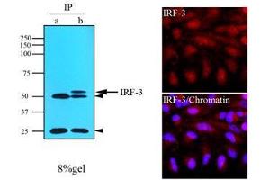 Immunofluorescenitrocellulosee of human HeLa cells stained with IRF-3 (1:500) with Texas-Red and Hoechst 33342 (Blue) for nucleus staining. (IRF3 antibody  (AA 108-166))