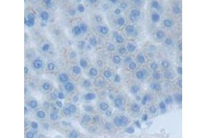 Figure. (COMT antibody  (AA 63-264))