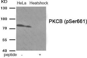 Western blot analysis of extracts from HeLa cells treated with Heatshock using Phospho-PKCB (Ser661) antibody. (PKC beta antibody  (pSer661))