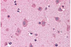 Human Brain, Cortex: Formalin-Fixed, Paraffin-Embedded (FFPE) (COPS8 antibody  (C-Term))