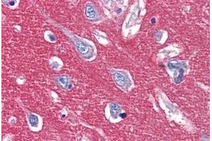 Anti-CADM2 antibody  ABIN1048369 IHC staining of human brain, cortex. (CADM2 antibody  (Internal Region))