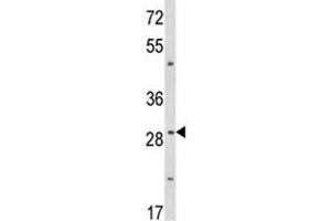 Western blot analysis of TTP antibody and WiDr lysate (ZFP36 antibody  (AA 116-142))