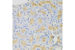 Immunohistochemistry of paraffin-embedded rat kidney using SYK Antibody (ABIN5971150) at dilution of 1/100 (40x lens). (SYK antibody)