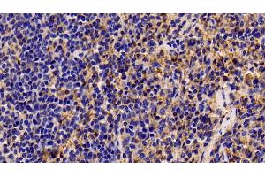 Immunohistochemistry (IHC) image for anti-Annexin A5 (ANXA5) (AA 1-321) antibody (ABIN7431455)