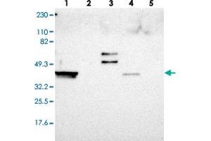 Western blot analysis of Lane 1: RT-4, Lane 2: U-251 MG, Lane 3: Human Plasma, Lane 4: Liver, Lane 5: Tonsil with ERICH1 polyclonal antibody  at 1:250-1:500 dilution. (ERICH1 antibody)