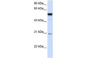 WB Suggested Anti-AIRE Antibody Titration:  0. (AIRE antibody  (Middle Region))