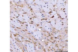 IHC analysis of SRGAP3 using anti-SRGAP3 antibody (ABIN7602538). (SRGAP3 antibody  (AA 824-1067))