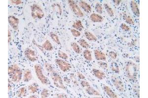 IHC-P analysis of Human Stomach Tissue, with DAB staining. (Phospholipase C gamma 1 antibody  (AA 1091-1290))