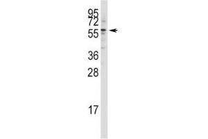Western blot analysis of Tip60 antibody in Jurkat lysate (KAT5 antibody  (AA 33-64))