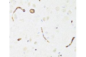 Immunohistochemistry of paraffin-embedded Rat brain using P Glycoprotein Polyclonal Antibody at dilution of 1:100 (40x lens). (P-Glycoprotein antibody)