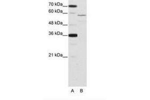 Image no. 1 for anti-Neuro-Oncological Ventral Antigen 2 (NOVA2) (AA 185-234) antibody (ABIN202652) (NOVA2 antibody  (AA 185-234))