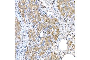 Immunohistochemistry of paraffin-embedded rat ovary using GCN2 Rabbit pAb (ABIN6127829, ABIN6140031, ABIN6140033 and ABIN6216318) at dilution of 1:250 (40x lens).