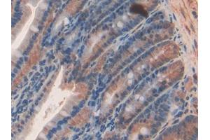 DAB staining on IHC-P; Samples: Rat Intestine Tissue