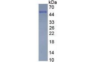 SDS-PAGE analysis of Human Vimentin Protein.