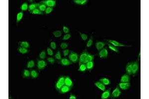 Immunofluorescent analysis of PC-3 cells using ABIN7156631 at dilution of 1:100 and Alexa Fluor 488-congugated AffiniPure Goat Anti-Rabbit IgG(H+L) (IRF7 antibody  (AA 131-289))