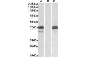 HEK293 lysate (10ug protein in RIPA buffer) overexpressing Human PIM2 with C-terminal MYC tag probed with ABIN2564540 (0. (PIM2 antibody  (C-Term))