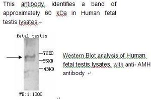 Image no. 1 for anti-Anti-Mullerian Hormone (AMH) antibody (ABIN790790)