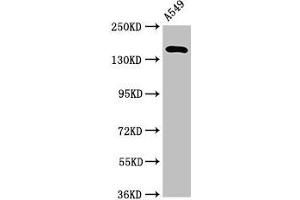 Western Blot Positive WB detected in: A549 whole cell lysate All lanes: A2ML1 antibody at 3. (A2ML1 antibody  (AA 625-751))
